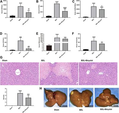 Bicyclol Alleviates Signs of BDL-Induced Cholestasis by Regulating Bile Acids and Autophagy-Mediated HMGB1/p62/Nrf2 Pathway